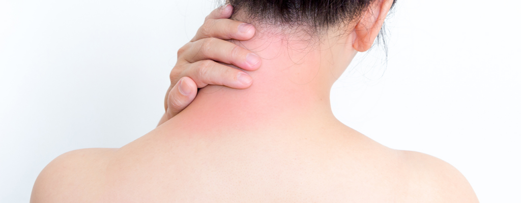 Fibromyalgia 0719 1280x500 1